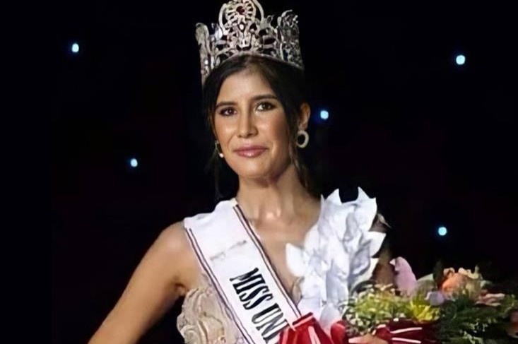 Nhan sac bi che gia cua Hoa hau Hoan vu Paraguay 2020 hinh anh