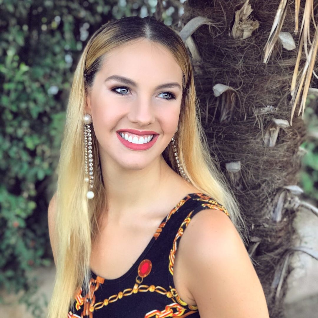 Hoa hau Hoan vu Argentina bi che giong chuyen gioi anh 10