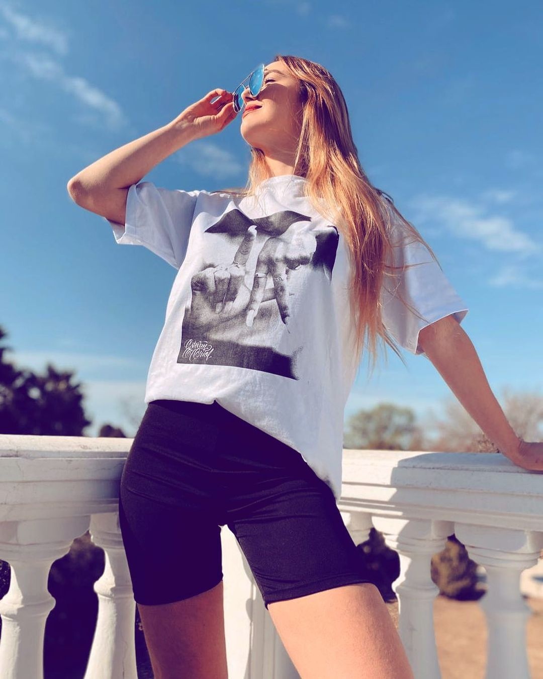 Hoa hậu Hoàn vũ Argentina bị chê giống chuyển giới ảnh 8 Hoa hau Hoan vu Argentina bi che giong chuyen gioi anh 8