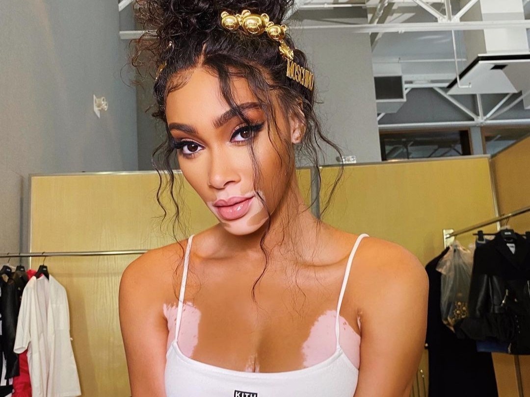 Nguoi mau noi y Winnie Harlow tang 11 kg hinh anh