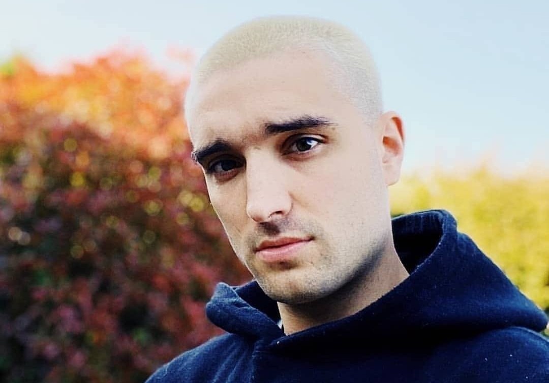 Ca si Tom Parker suy giam tri nho vi dieu tri ung thu hinh anh