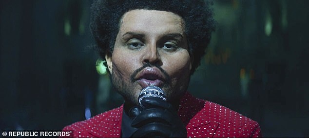 the weeknd phau thuat tham my anh 1