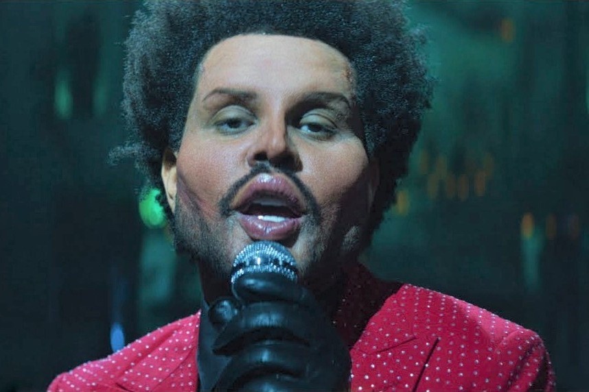 Tao hinh bi vi nhu phau thuat tham my hong cua The Weeknd hinh anh