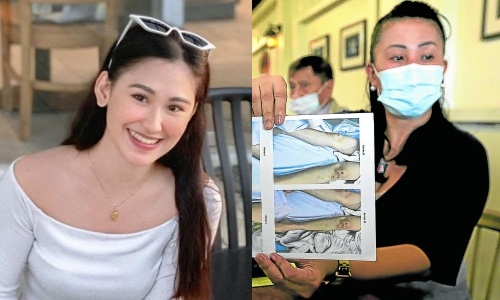 Vu nguoi dep Philippines tu vong: Gia dinh muon kham nghiem lai tu thi hinh anh