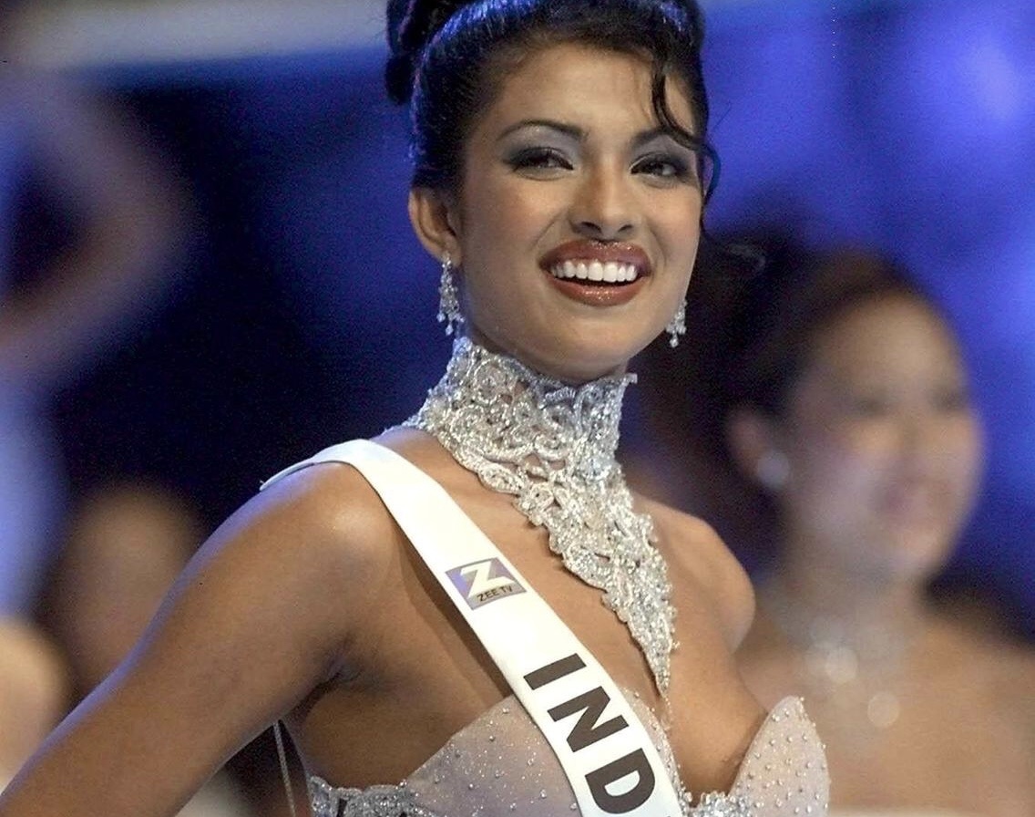 Hoa hau The gioi Priyanka Chopra tung bi yeu cau phau thuat tham my hinh anh