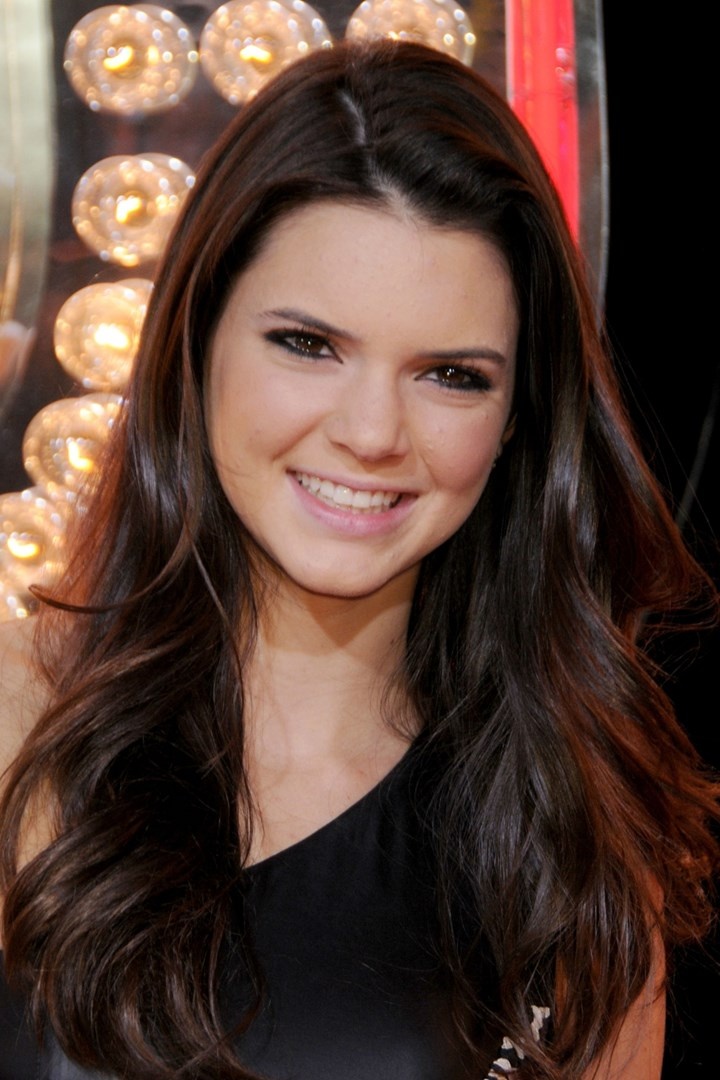 kendall jenner phẫu thuật thẩm mỹ ảnh 2 kendall jenner phau thuat tham my anh 2