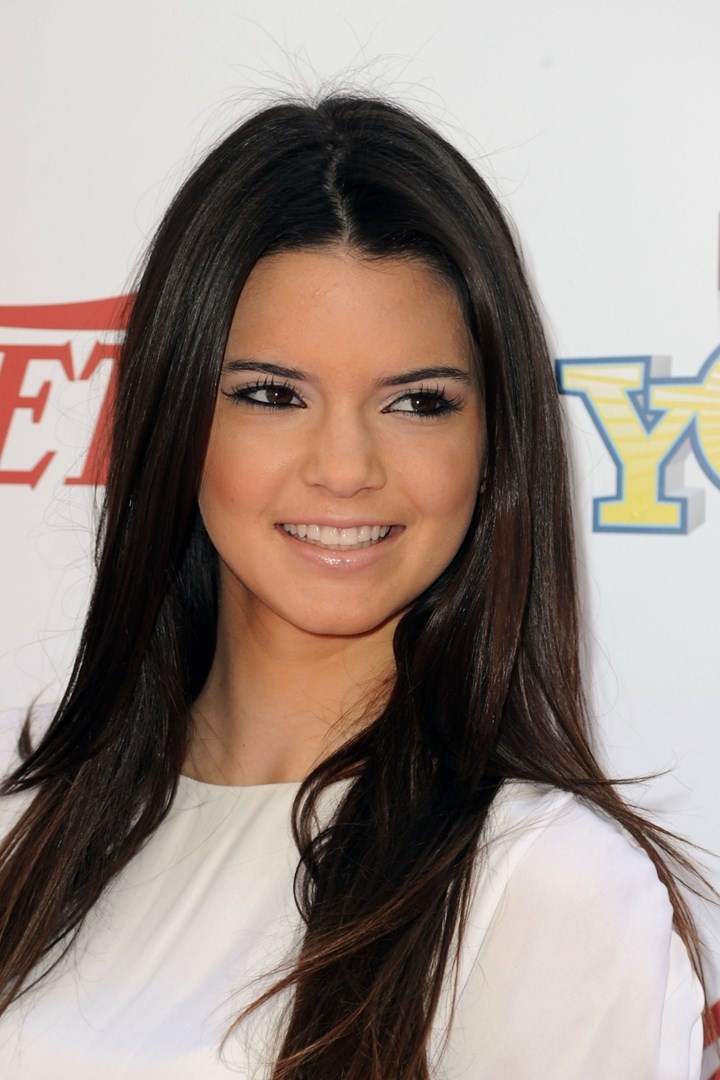 kendall jenner phẫu thuật thẩm mỹ ảnh 8 kendall jenner phau thuat tham my anh 8