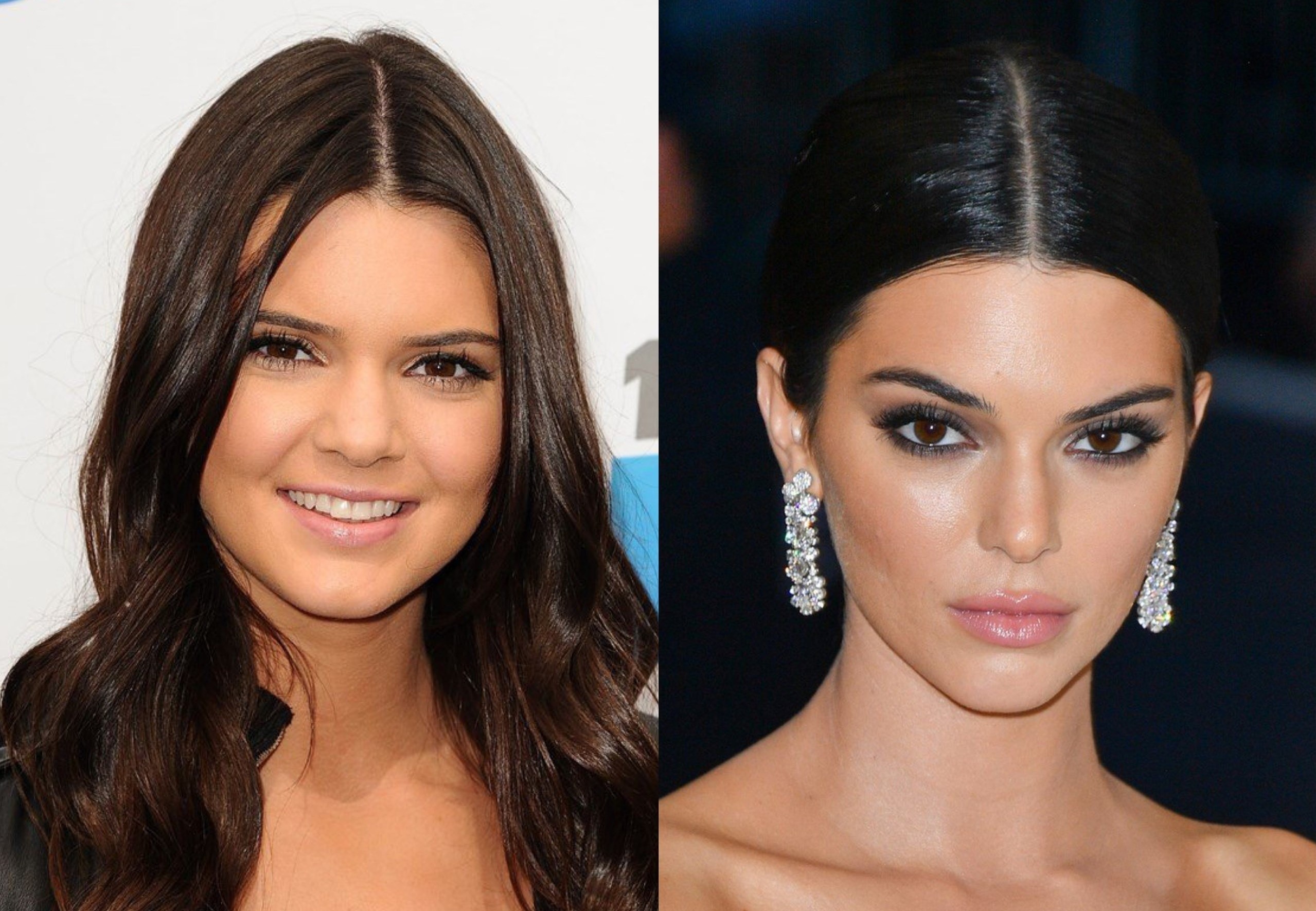 Kendall Jenner chinh sua bao nhieu diem tren co the? hinh anh