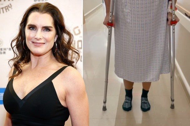 Dien vien 'Eo bien xanh' Brooke Shields bi nga gay xuong dui hinh anh