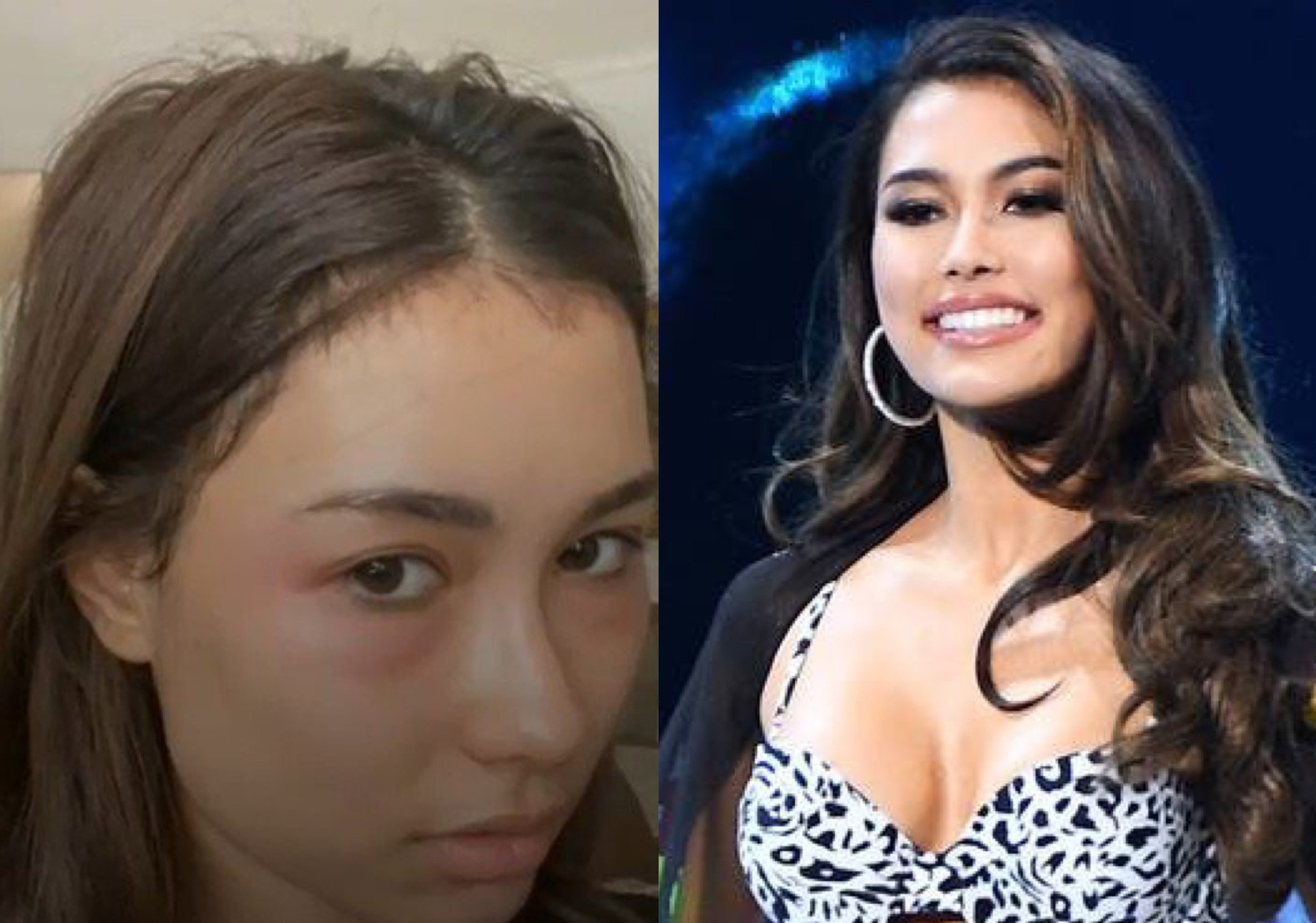 Hoa hau Hoan vu Indonesia bi bong mat hinh anh