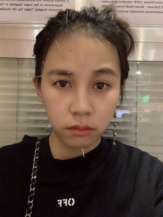 Trần Tiểu Lôi bị u não ảnh 3 Tran Tieu Loi bi u nao anh 3