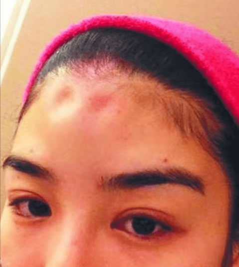 huỳnh dịch bị chồng cũ bạo hành ảnh 3 huynh dich bi chong cu bao hanh anh 3