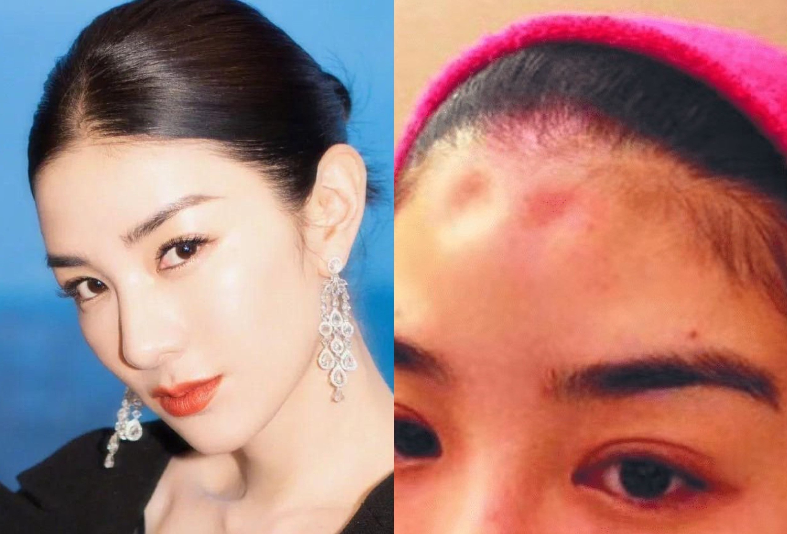 Huynh Dich to bi chong cu bao hanh khi mang bau hinh anh