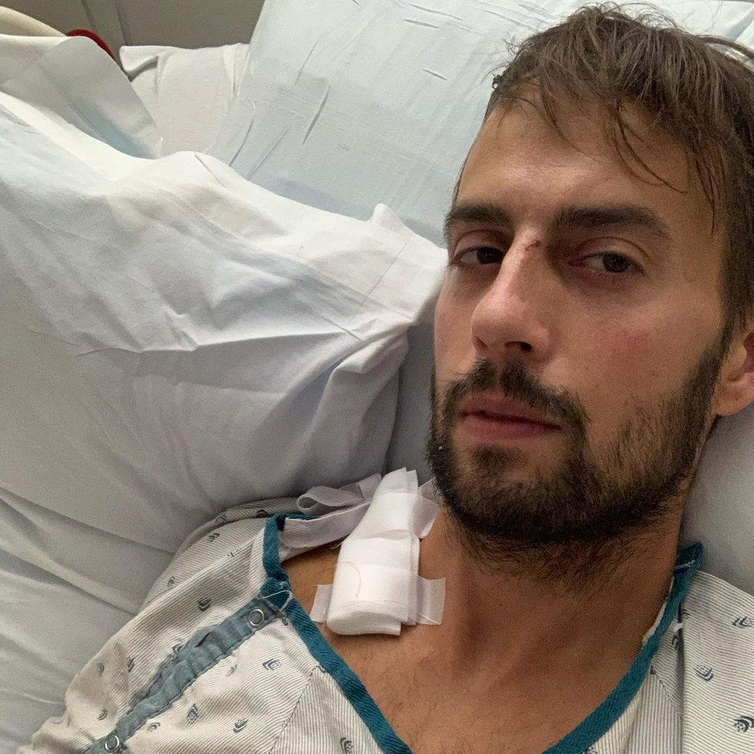 Lady Gaga bi trom cho anh 2