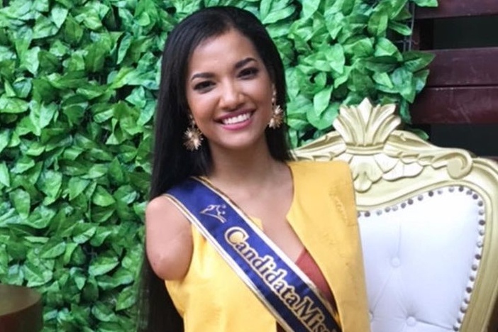 Ve dep cua cac co gai khuyet tat tai cuoc thi hoa hau hinh anh