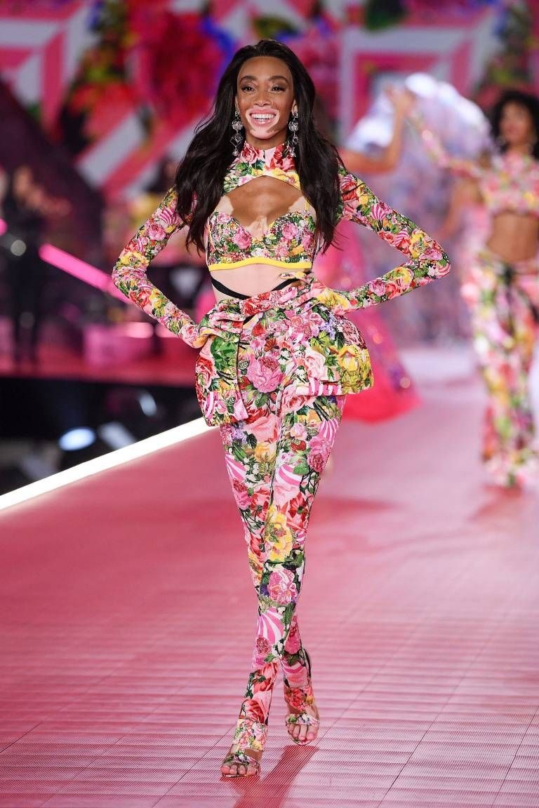 sao hollywood mắc bệnh bạch biến ảnh 3 sao hollywood mac benh bach bien anh 3