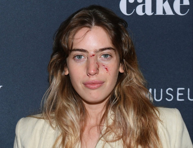 nu dien vien bi cho can anh 2