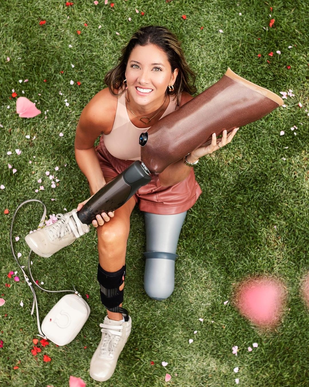 hoa hậu colombia phẫu thuật cưa chân ảnh 12 hoa hau colombia phau thuat cua chan anh 12