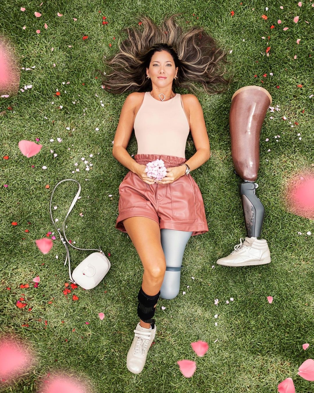 hoa hậu colombia phẫu thuật cưa chân ảnh 13 hoa hau colombia phau thuat cua chan anh 13