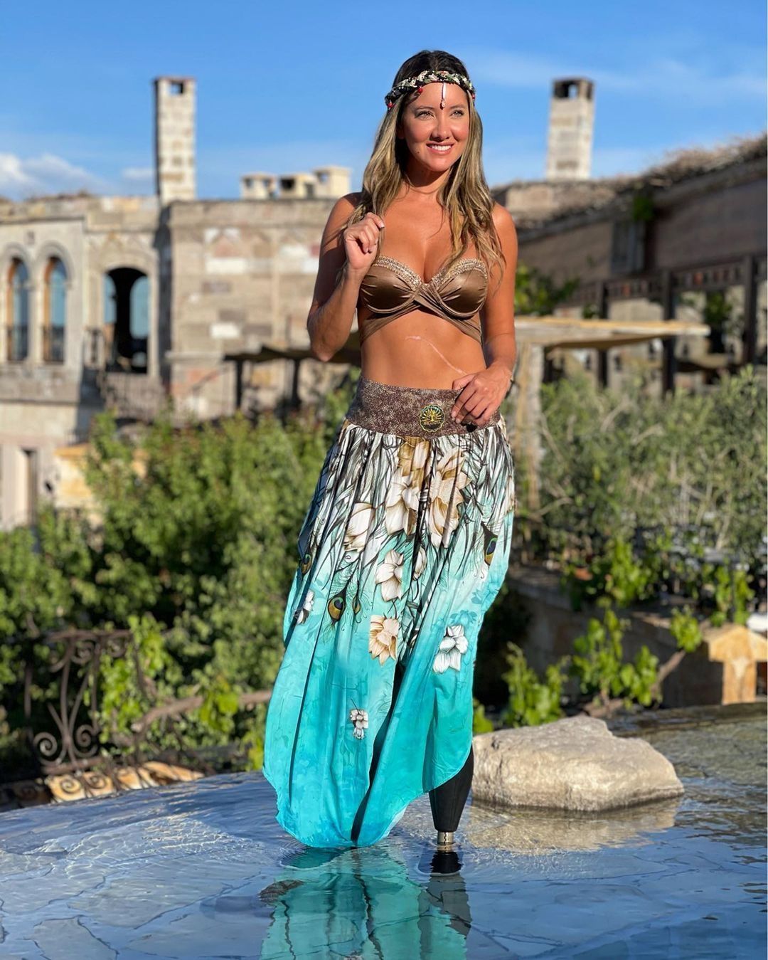 hoa hậu colombia phẫu thuật cưa chân ảnh 4 hoa hau colombia phau thuat cua chan anh 4