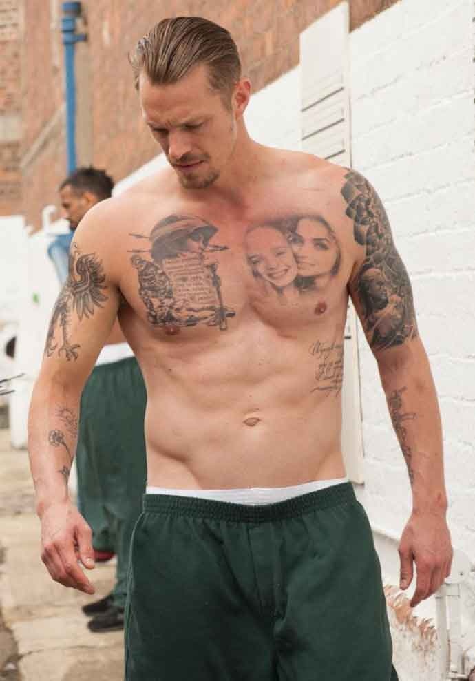 diễn viên The Suicide Squad mắc bệnh hiếm gặp ảnh 3 dien vien The Suicide Squad mac benh hiem gap anh 3