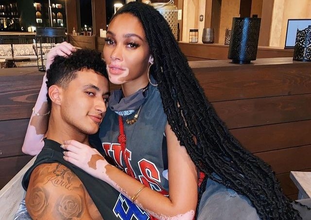 Nguoi mau bach bien Winnie Harlow chia tay ban trai hinh anh