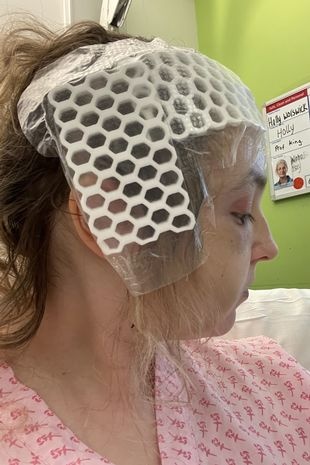 hoa hậu anh bị u não ảnh 1 hoa hau anh bi u nao anh 1