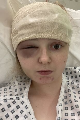 hoa hậu anh bị u não ảnh 2 hoa hau anh bi u nao anh 2