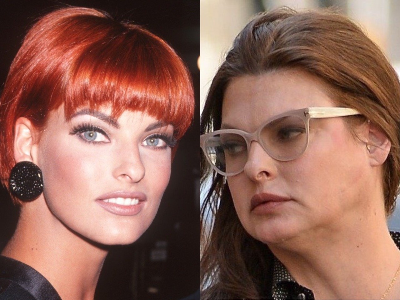 Nguoi noi tieng hoi han vi phau thuat tham my anh 1