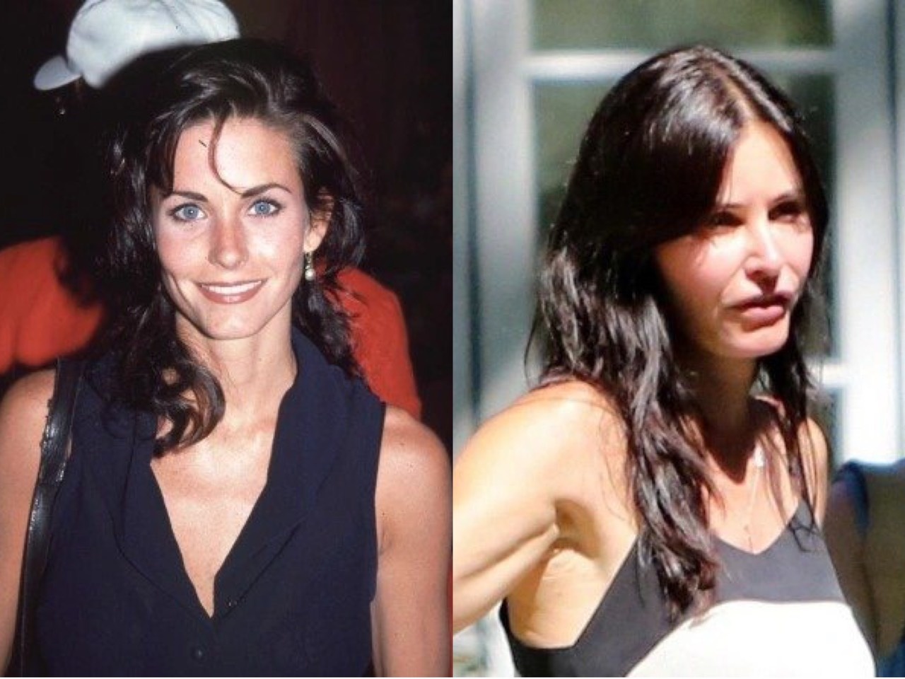 Nguoi noi tieng hoi han vi phau thuat tham my anh 2