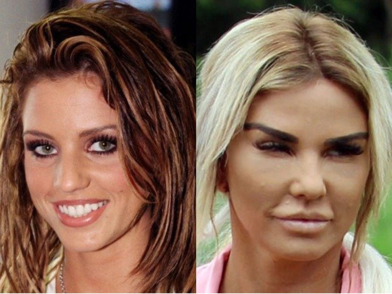 Nguoi noi tieng hoi han vi phau thuat tham my anh 9