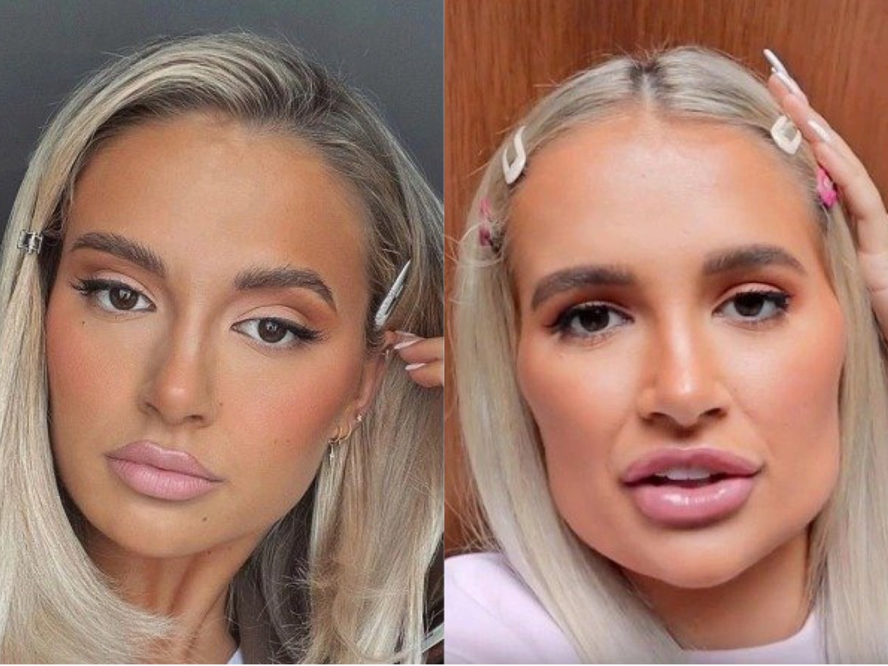 Nguoi noi tieng hoi han vi phau thuat tham my anh 7