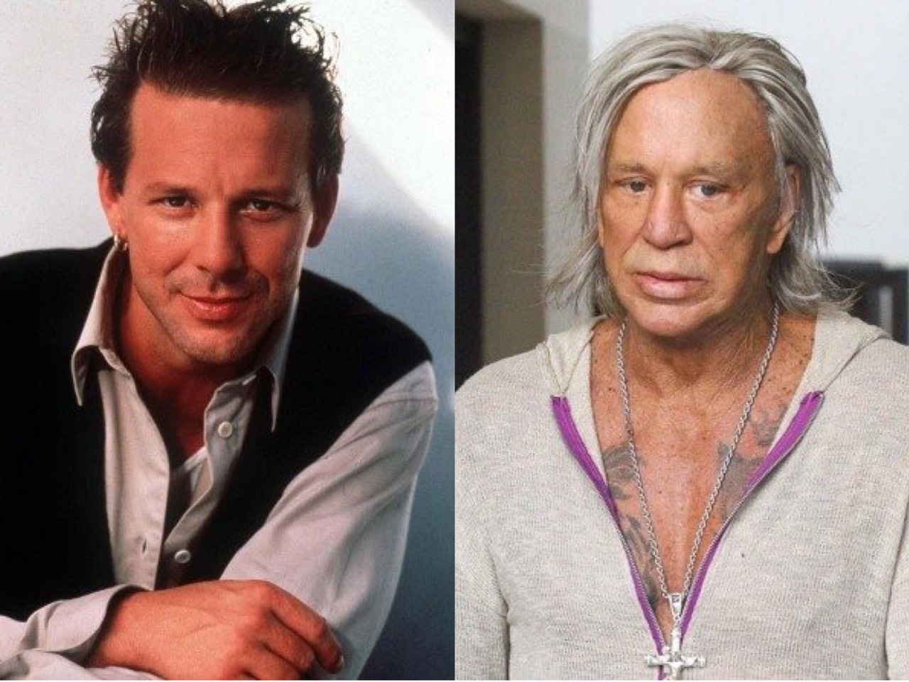 Nguoi noi tieng hoi han vi phau thuat tham my anh 6