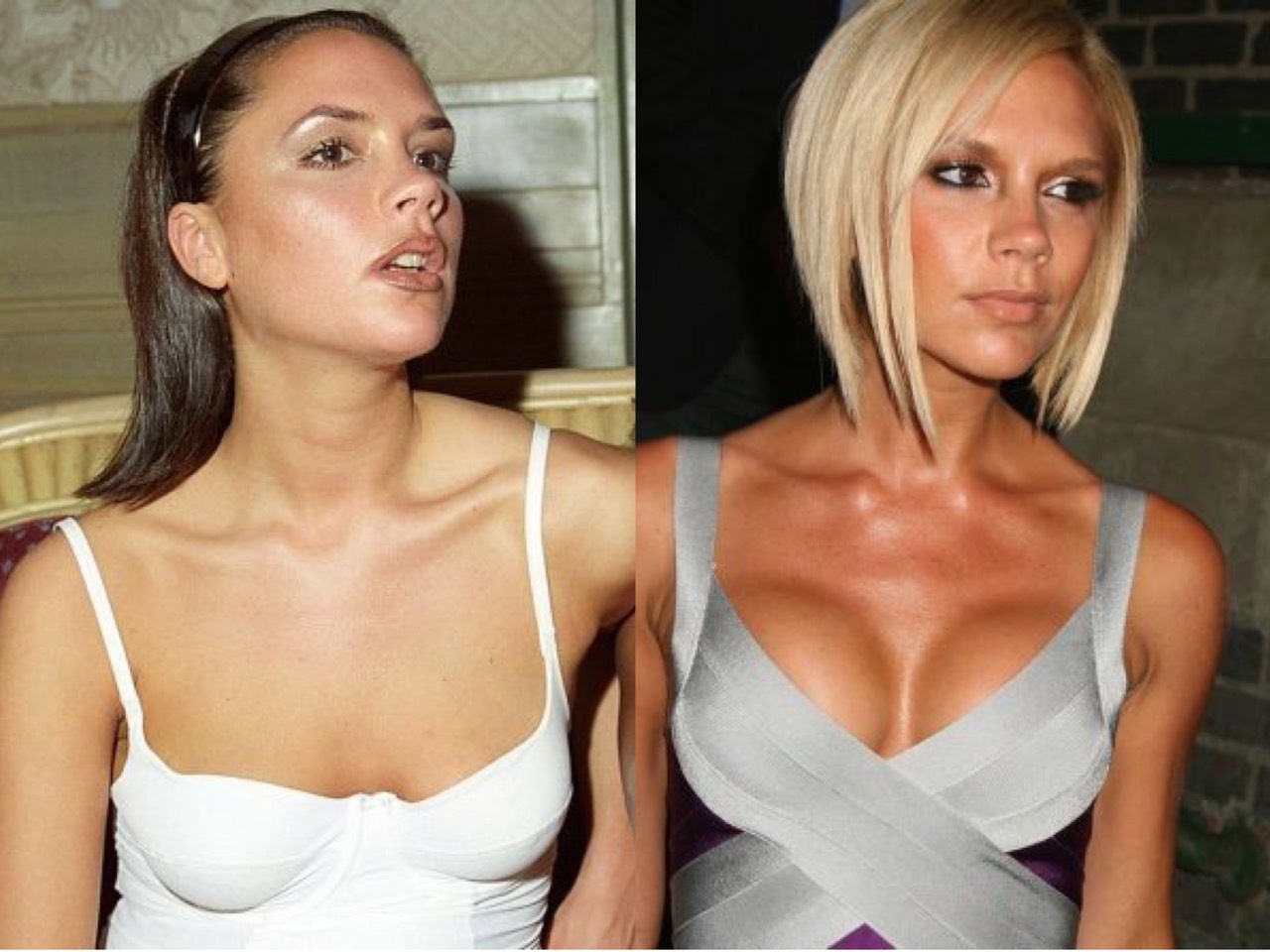 Nguoi noi tieng hoi han vi phau thuat tham my anh 5