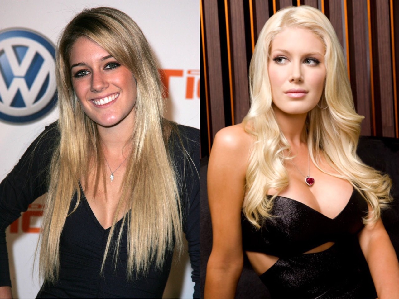 Nguoi noi tieng hoi han vi phau thuat tham my anh 4