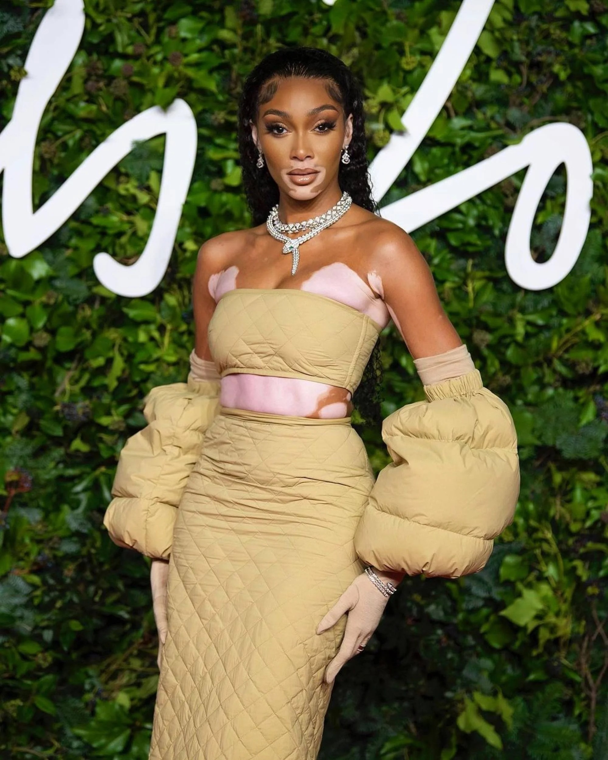 co gai mac hoi chung Down lam nguoi mau anh 4