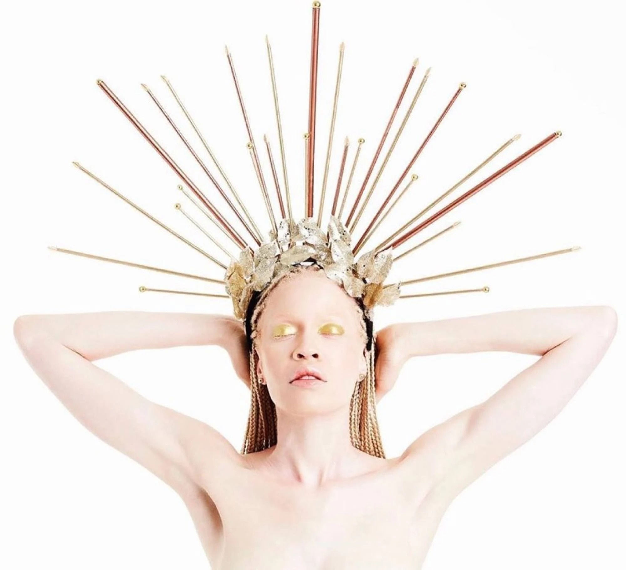 co gai mac hoi chung Down lam nguoi mau anh 10