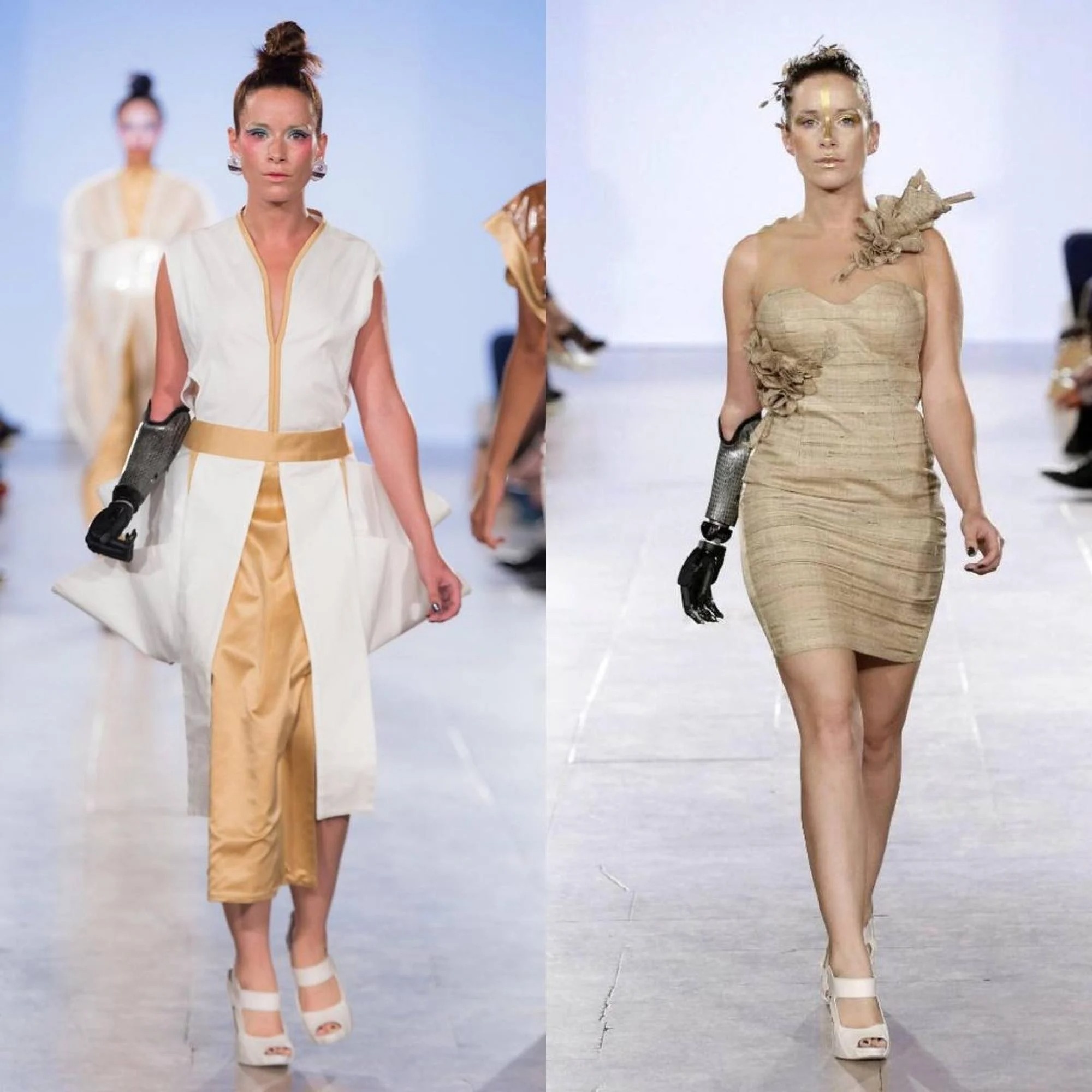 co gai mac hoi chung Down lam nguoi mau anh 13