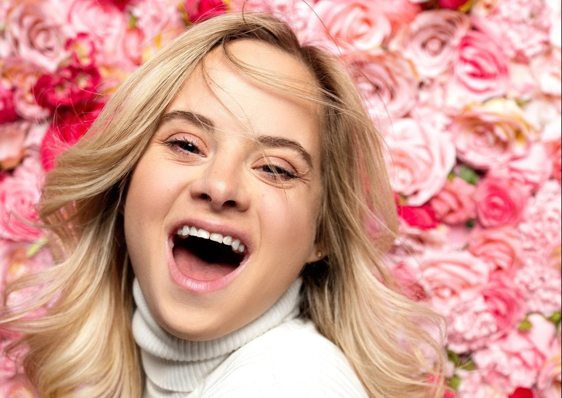 Co gai mac hoi chung Down va nhung nguoi mau quoc te khac biet hinh anh