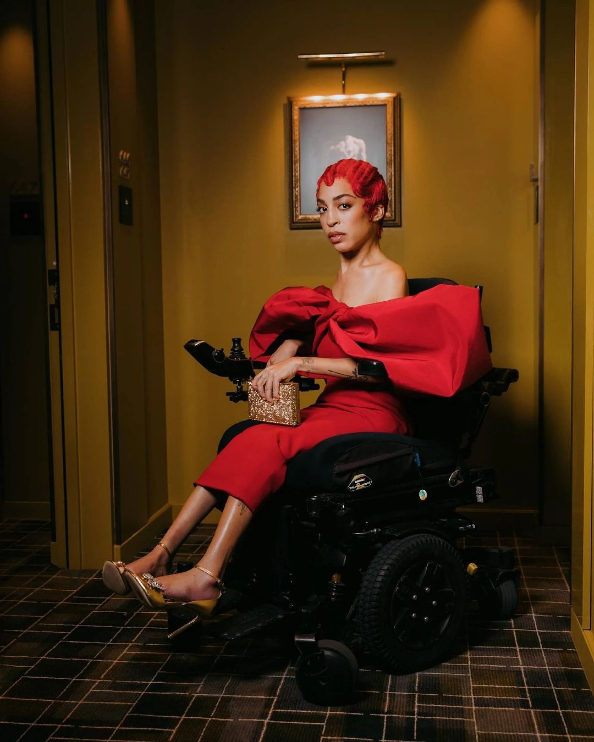 co gai mac hoi chung Down lam nguoi mau anh 8