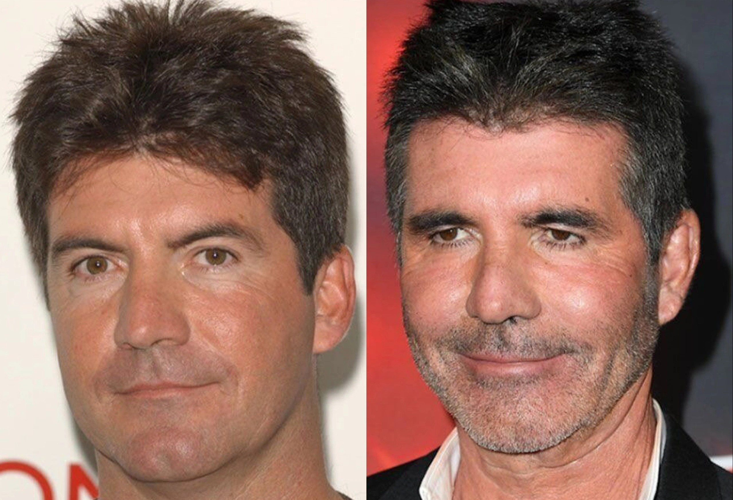 Simon Cowell bi chi trich vi tiem botox va am anh phai dep cua sao nam hinh anh