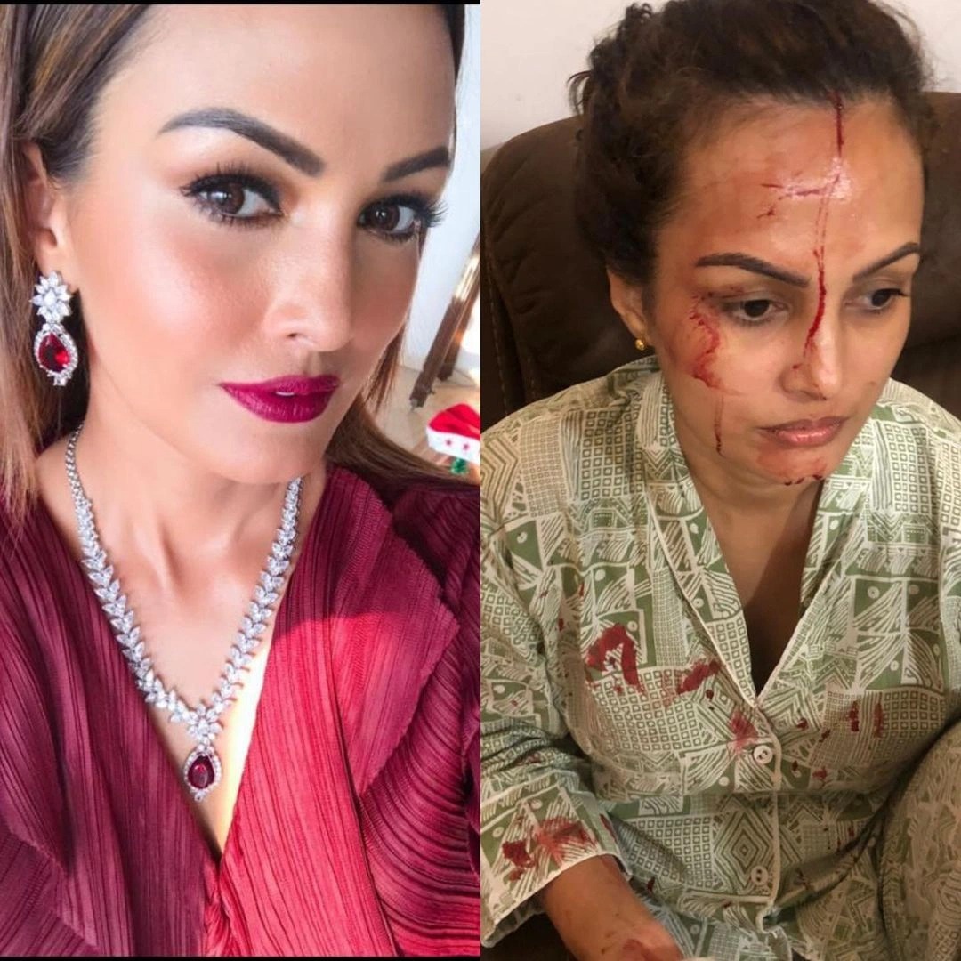 nguoi mau An Do bi bao hanh anh 2