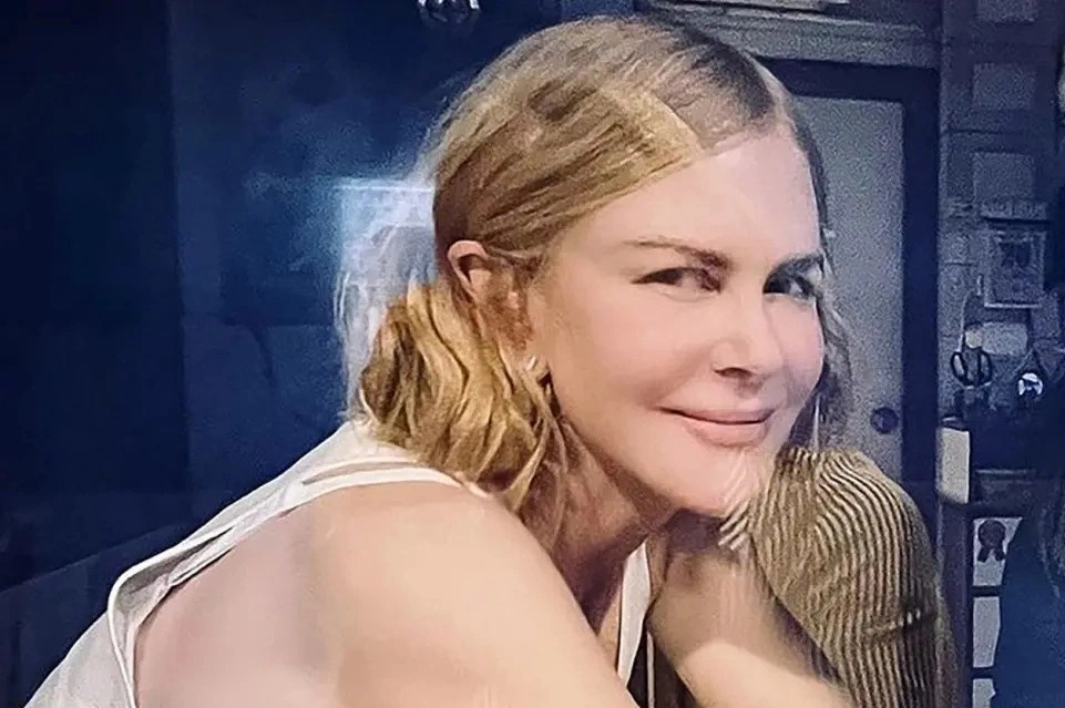 Buc anh gay tranh cai cua Nicole Kidman hinh anh