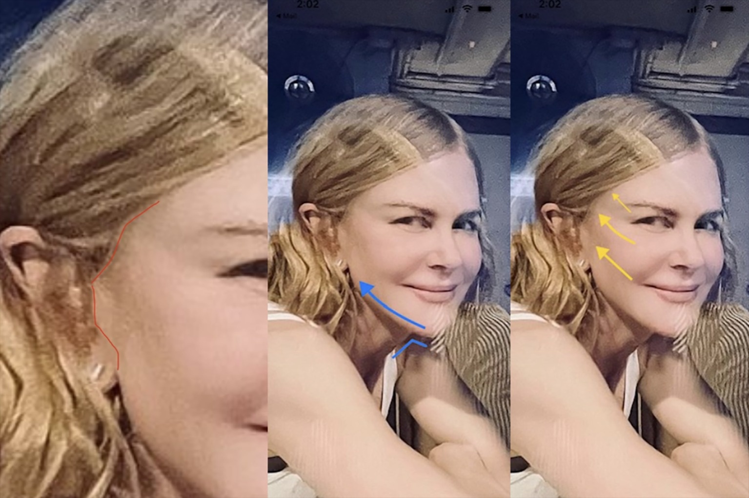 Guong mat khac la cua Nicole Kidman anh 2