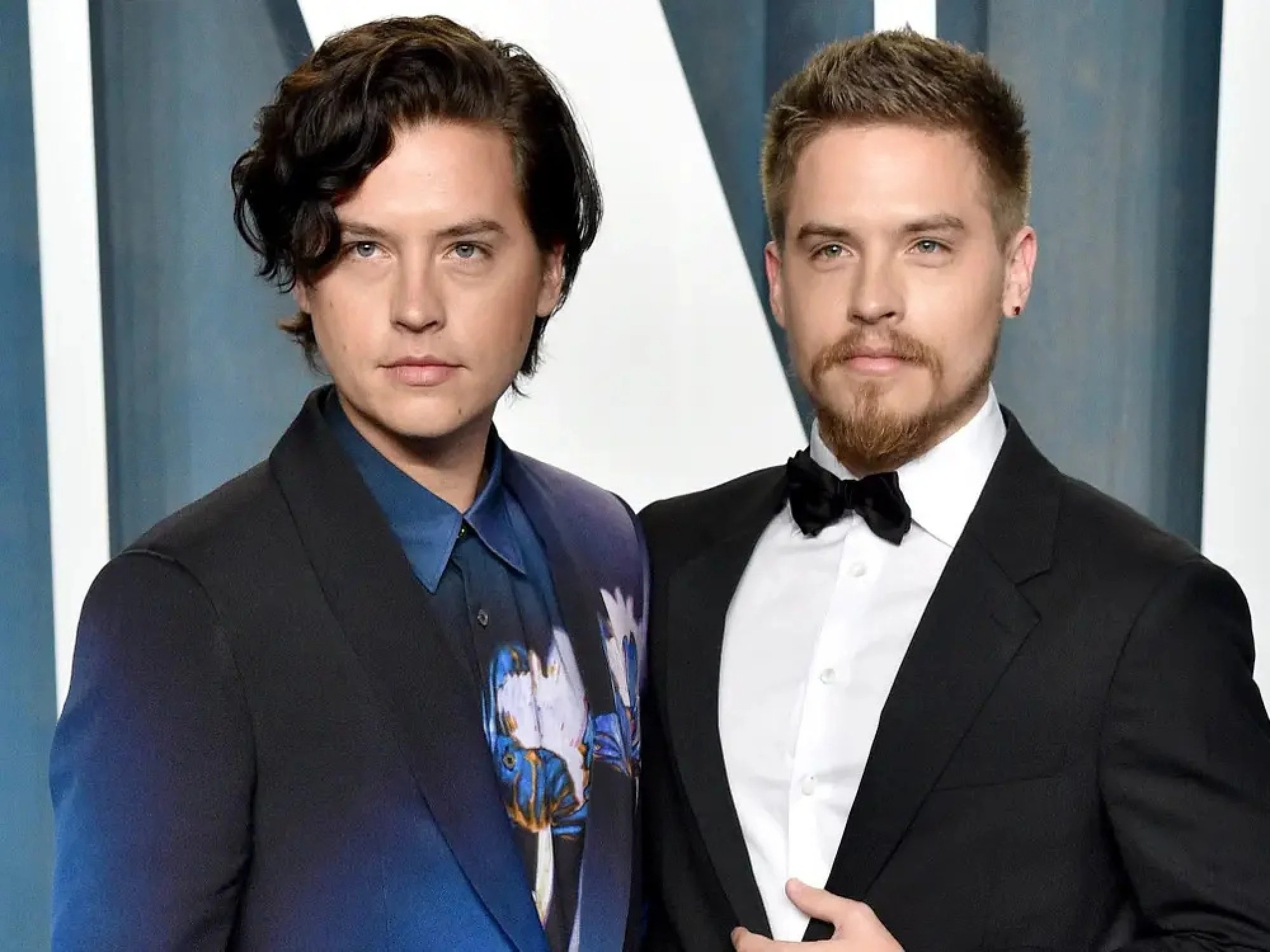 nhung song sinh noi tieng nhat Hollywood anh 2