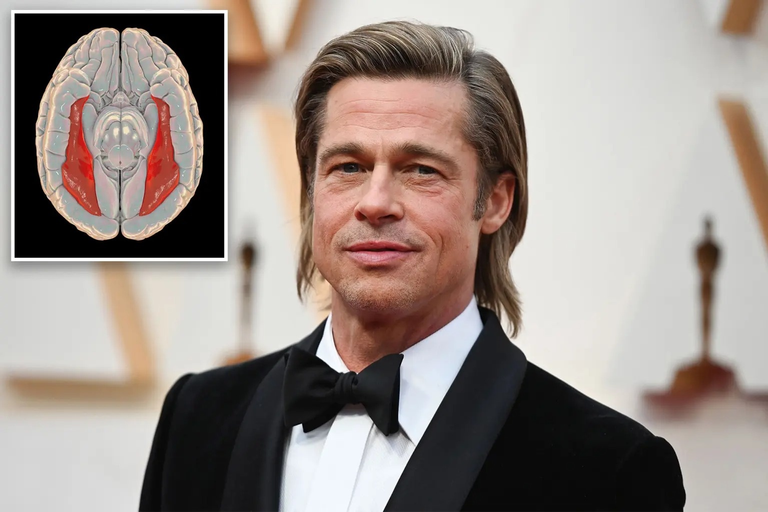 Brad Pitt bi mu mat anh 1