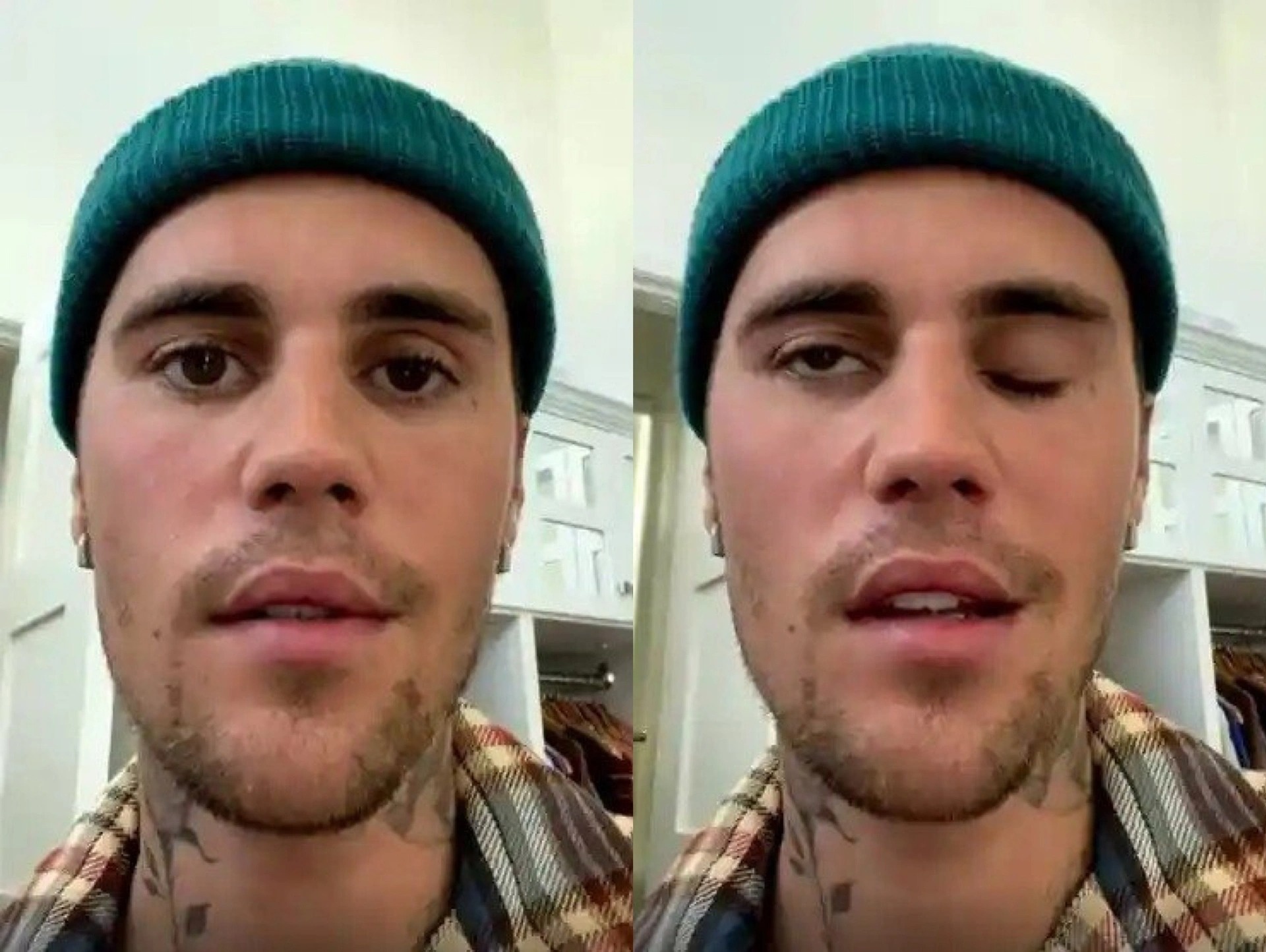 Brad Pitt mac hoi chung mu mat anh 4