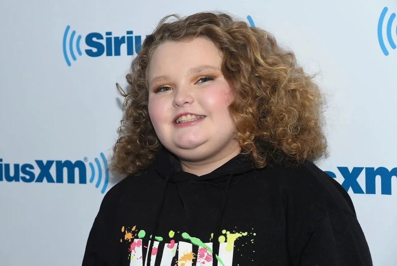 Hoa hau nhi phau thuat de giam 124 kg xuong 68 kg hinh anh