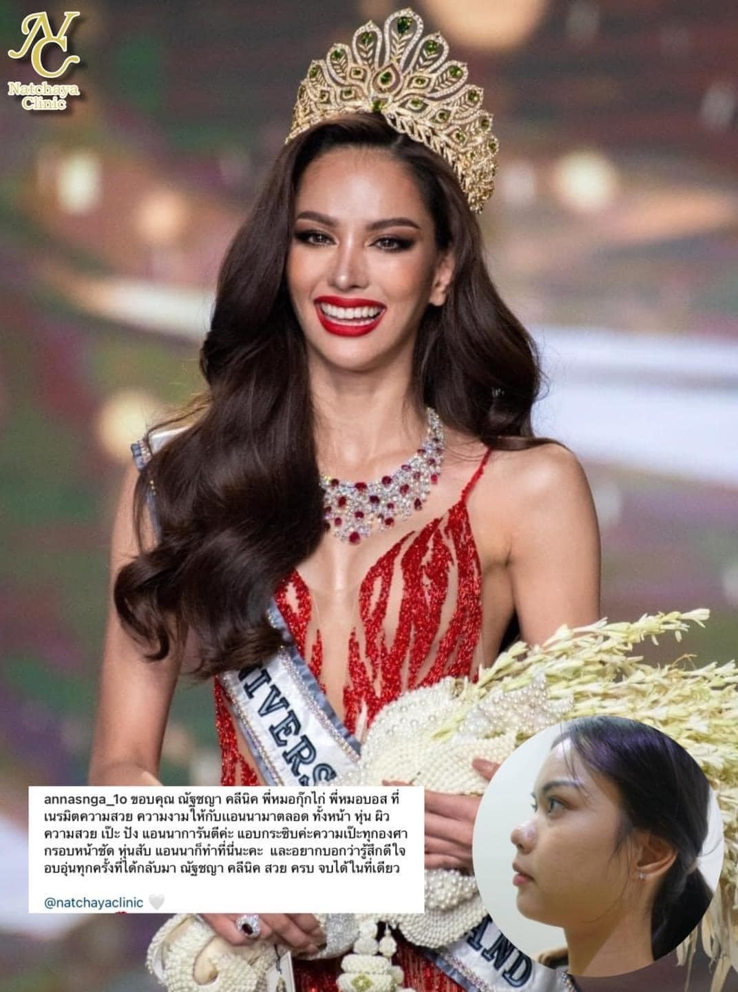 Hoa hậu Hoàn vũ Thái Lan ảnh 3 Hoa hau Hoan vu Thai Lan anh 3