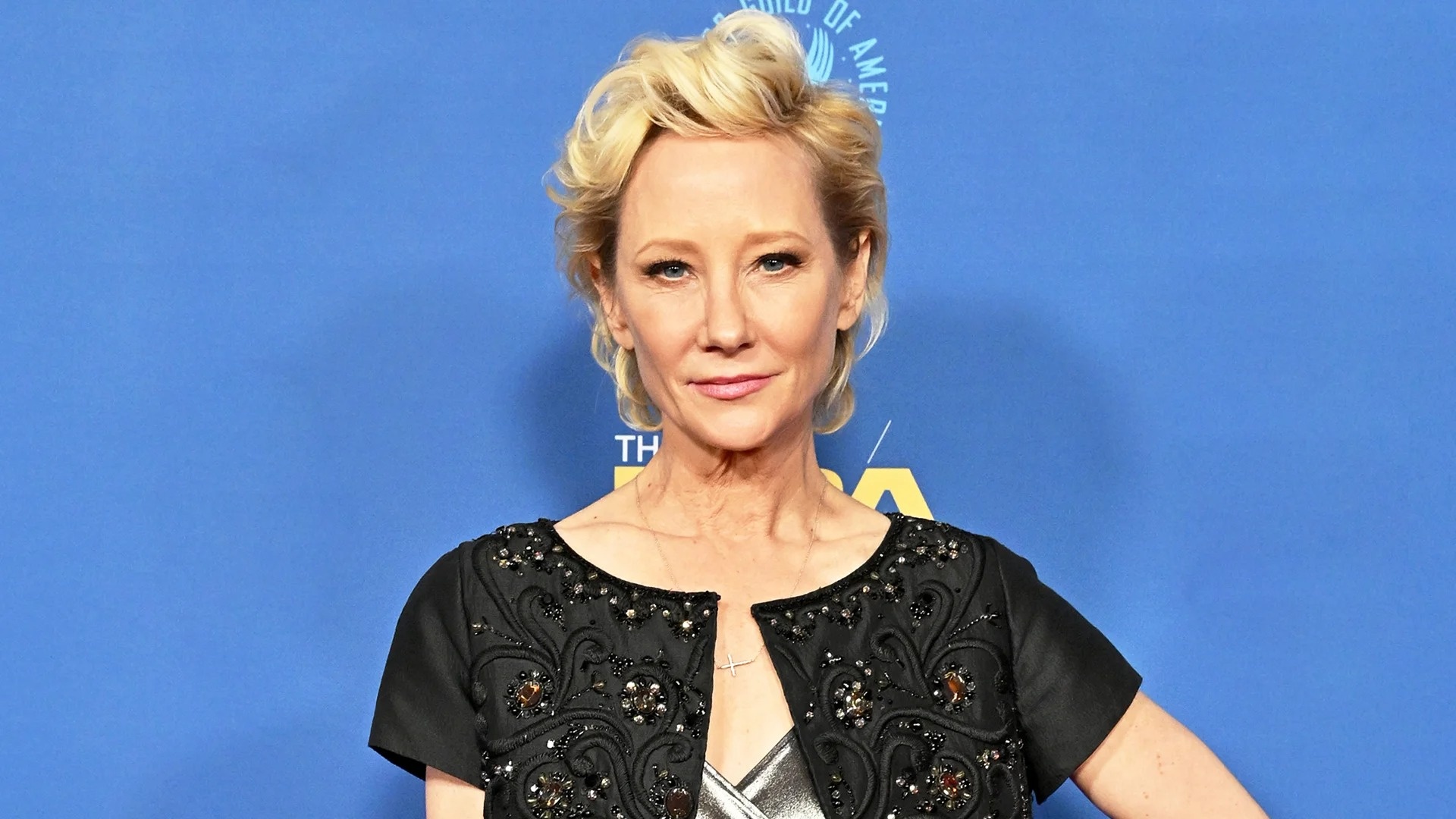 Anne Heche bong nang sau tai nan oto anh 2